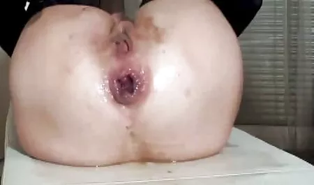 Infirmière noire étouffe son patient - partie 3 vidéo porno de