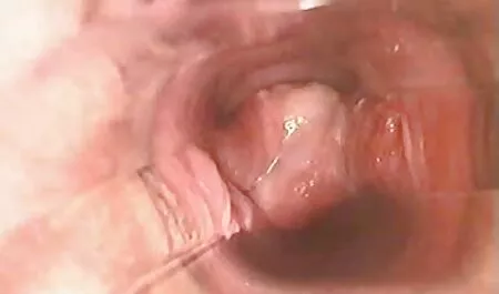 fille cannadienne les video porno chaude